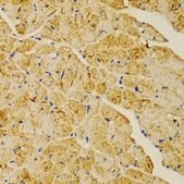 Anti-ACTN1 antibody produced in rabbit