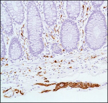 Anti-S100 Beta antibody, Rabbit monoclonal clone SP127, recombinant, expressed in proprietary host, affinity isolated antibody