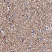 Anti-ASCC3 antibody produced in rabbit Prestige Antibodies&#174; Powered by Atlas Antibodies, affinity isolated antibody, buffered aqueous glycerol solution, ab3