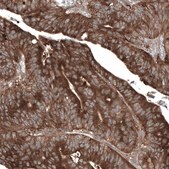 Anti-GSPT1 antibody produced in mouse Prestige Antibodies&#174; Powered by Atlas Antibodies, clone CL13336, purified by using Protein A, buffered aqueous glycerol solution