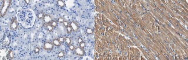 Anti-ARHGEF28 Antibody, clone 14C10.1 clone 14C10.1, from mouse