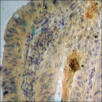 Anti-phospho-GSK3 &#945;/&#946; (pTyr279/216) antibody produced in rabbit affinity isolated antibody