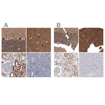 Anti-ACOT7 antibody produced in rabbit Prestige Antibodies&#174; Powered by Atlas Antibodies, affinity isolated antibody, buffered aqueous glycerol solution, Ab1