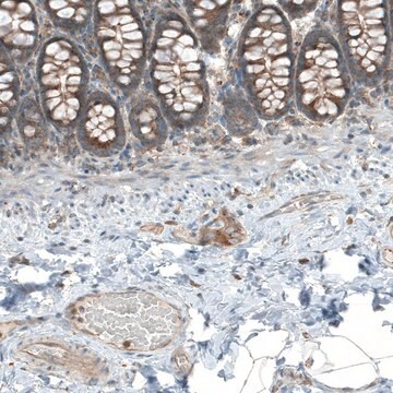 Anti-LZTR1 antibody produced in rabbit Prestige Antibodies&#174; Powered by Atlas Antibodies, affinity isolated antibody, buffered aqueous glycerol solution