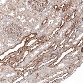 Anti-KLHL24 antibody produced in rabbit Prestige Antibodies&#174; Powered by Atlas Antibodies, affinity isolated antibody, buffered aqueous glycerol solution