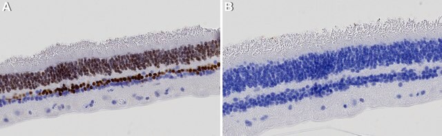 Anti-OTX2 Antibody, clone 1O4 ZooMAb&#174; Rabbit Monoclonal recombinant, expressed in HEK 293 cells