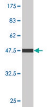 Monoclonal Anti-C4BPB antibody produced in mouse clone 1G9, purified immunoglobulin, buffered aqueous solution