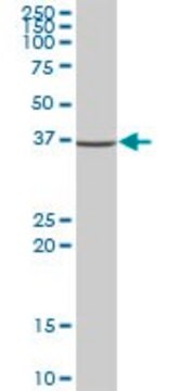 Anti-NSDHL antibody produced in mouse purified immunoglobulin, buffered aqueous solution