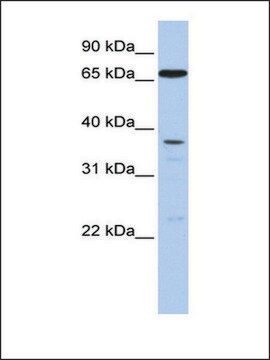 Anti-ABCB9 antibody produced in rabbit affinity isolated antibody