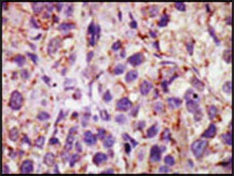 Anti-USP11 (C-term) antibody produced in rabbit IgG fraction of antiserum, buffered aqueous solution