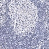 Anti-SLC22A12 antibody produced in rabbit Prestige Antibodies&#174; Powered by Atlas Antibodies, affinity isolated antibody, buffered aqueous glycerol solution