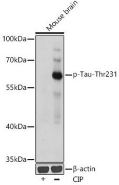 Anti-Phospho-Tau-Thr231 antibody produced in rabbit