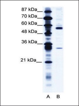 Anti-CORO1A (AB1) antibody produced in rabbit IgG fraction of antiserum