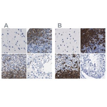 Anti-MS4A1 antibody produced in rabbit Prestige Antibodies&#174; Powered by Atlas Antibodies, affinity isolated antibody, buffered aqueous glycerol solution