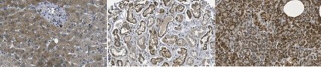 Anti-Nicotinamide N-methyltransferase from rabbit, purified by affinity chromatography