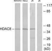 Anti-HDAC8 antibody produced in rabbit affinity isolated antibody