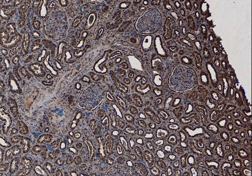 Anti-SET/I2 &#945; PP2A antibody produced in goat affinity isolated antibody, buffered aqueous solution