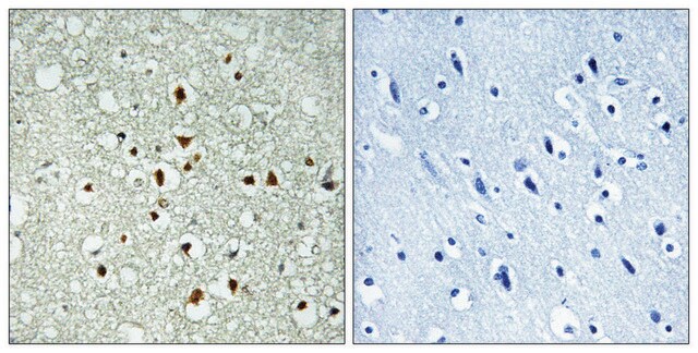 Anti-MAX antibody produced in rabbit affinity isolated antibody