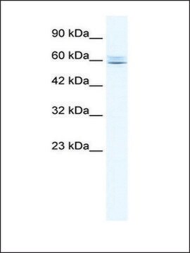 Anti-CBFA2T3 (AB1) antibody produced in rabbit affinity isolated antibody
