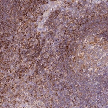 Anti-CORO7 antibody produced in rabbit Prestige Antibodies&#174; Powered by Atlas Antibodies, affinity isolated antibody, buffered aqueous glycerol solution