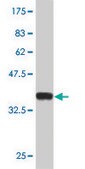 Monoclonal Anti-MECP2 antibody produced in mouse clone 1B11, purified immunoglobulin, buffered aqueous solution