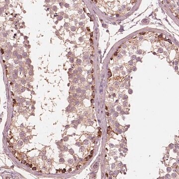 Anti-STK33 antibody produced in rabbit Prestige Antibodies&#174; Powered by Atlas Antibodies, affinity isolated antibody