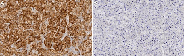 Anti-CYP11B1 Antibody, clone 1J14 ZooMAb&#174; Rabbit Monoclonal recombinant, expressed in HEK 293 cells