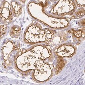 Anti-CSN1S1 antibody produced in rabbit Prestige Antibodies&#174; Powered by Atlas Antibodies, affinity isolated antibody