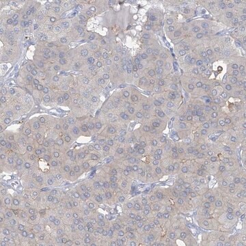 Anti-TRMT2B antibody produced in rabbit Prestige Antibodies&#174; Powered by Atlas Antibodies, affinity isolated antibody, buffered aqueous glycerol solution