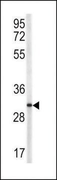 ANTI-TRAP(N-TERMINAL) antibody produced in rabbit purified immunoglobulin, buffered aqueous solution