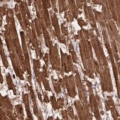 Anti-TNNC1 antibody produced in rabbit Prestige Antibodies&#174; Powered by Atlas Antibodies, affinity isolated antibody, buffered aqueous glycerol solution