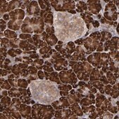 Anti-MTHFD1 antibody produced in rabbit Prestige Antibodies&#174; Powered by Atlas Antibodies, affinity isolated antibody, buffered aqueous glycerol solution