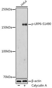 Anti-Phospho-LRP6-S1490 antibody produced in rabbit