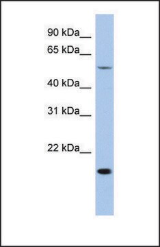 Anti-TEAD2 antibody produced in rabbit affinity isolated antibody