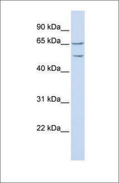 Anti-TTYH1 antibody produced in rabbit affinity isolated antibody