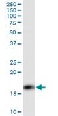 Monoclonal Anti-PPP3R1 antibody produced in mouse clone 4E1, purified immunoglobulin, buffered aqueous solution