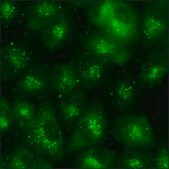 A549 Cells GFP-STAT1