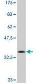 Monoclonal Anti-BCL11A antibody produced in mouse clone 3D9, purified immunoglobulin, buffered aqueous solution