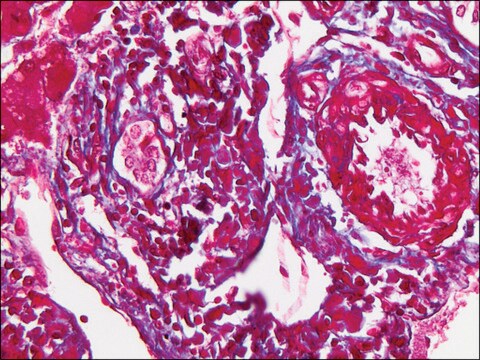 Trichrome Stain AB Solution