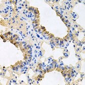 Anti-IGF1R antibody produced in rabbit