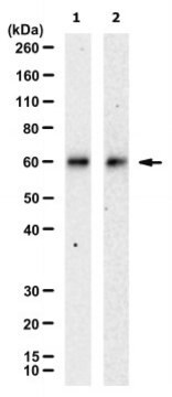 Anti-Tau (MTBR3R) Antibody, clone 4B5
