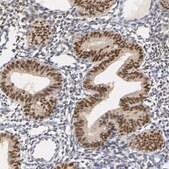 Anti-PGR antibody produced in rabbit Ab1, Prestige Antibodies&#174; Powered by Atlas Antibodies, affinity isolated antibody, buffered aqueous glycerol solution
