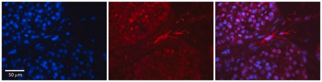 Anti-EWSR1 antibody produced in rabbit affinity isolated antibody