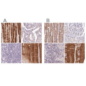 Anti-FAM168B antibody produced in rabbit Prestige Antibodies&#174; Powered by Atlas Antibodies, affinity isolated antibody, buffered aqueous glycerol solution