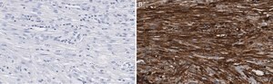 Anti-&#946;-Actin Antibody, clone 6L12, ZooMAb&#174; Rabbit Monoclonal recombinant, expressed in HEK 293 cells