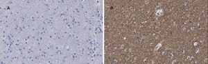 Anti-&#946;-Tubulin III Antibody, clone 5H16, ZooMAb&#174; Rabbit Monoclonal recombinant, expressed in HEK 293 cells