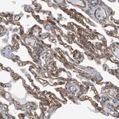 Anti-SGMS2 antibody produced in rabbit Prestige Antibodies&#174; Powered by Atlas Antibodies, affinity isolated antibody, buffered aqueous glycerol solution