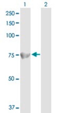 Anti-ACOX1 antibody produced in rabbit purified immunoglobulin, buffered aqueous solution