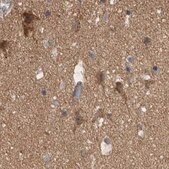 Anti-TSPOAP1 antibody produced in rabbit Prestige Antibodies&#174; Powered by Atlas Antibodies, affinity isolated antibody, buffered aqueous glycerol solution, Ab2