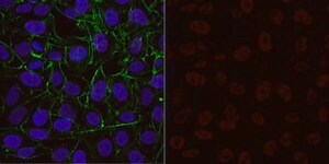 Anti-trimethyl Histone H3 (Lys4) Antibody, Alexa Fluor&#8482; 555 Conjugate from rabbit, ALEXA FLUOR&#8482; 555
